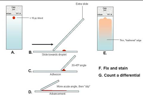 How to make a blood film